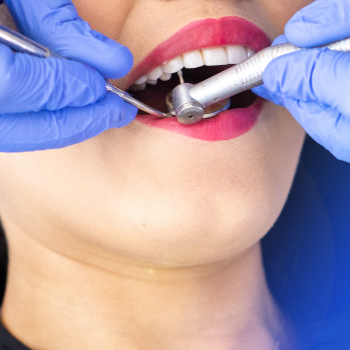 Détartrage dentaire : Pour des dents propres et saines chez Dentiste Midoun