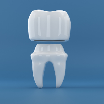 Inlay-Core : Renforcez vos dents avant la pose d’une couronne – Dentiste Midoun