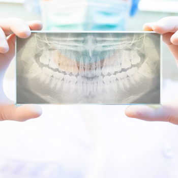 Radiologie numérique : Une technologie avancée pour un diagnostic précis – Dentiste Midoun