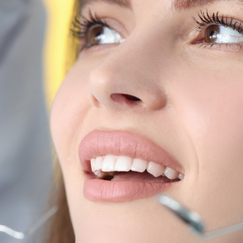 Restauration par résine composite : Esthétique et naturel pour vos dents – Dentiste Midoun