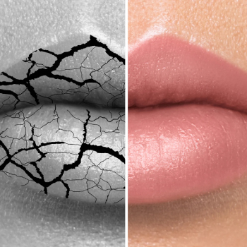 Sécheresse buccale : Soulagement naturel avec l’eau thermale Buccotherm chez Dentiste Midoun