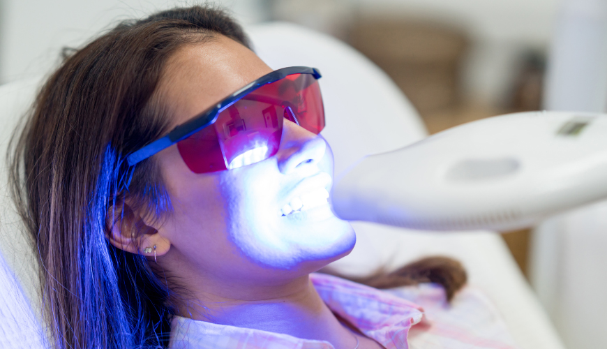 Blanchiment Express LED - Cabinet Dentaire Midoun Djerba – Dr Jaajaa Jamila