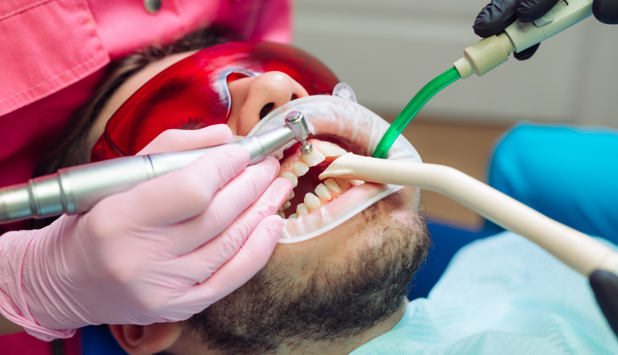 Détartrage Professionnel -  Cabinet Dentaire Midoun Djerba – Dr Jaajaa Jamila